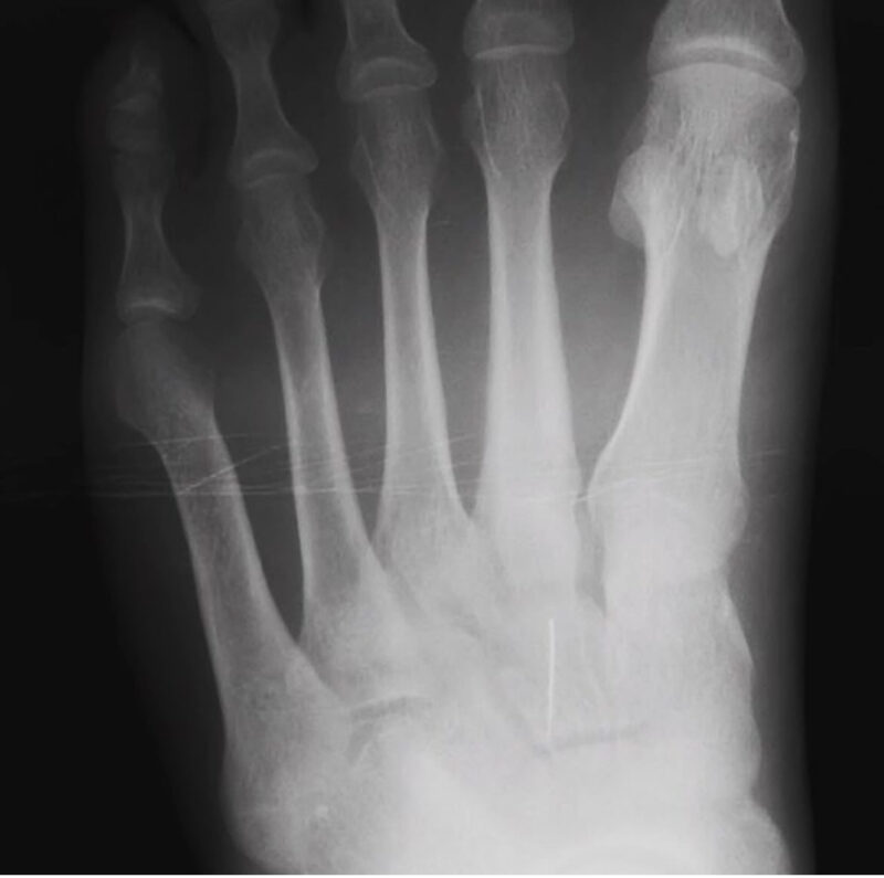 PG Rated XRay Stories Blue Rock Medical