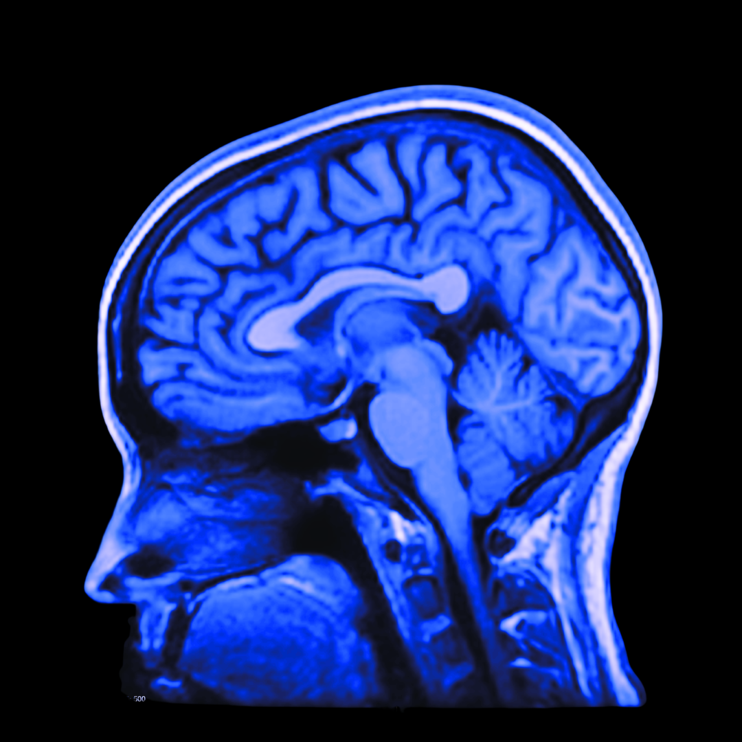 MRI Advanced Brain