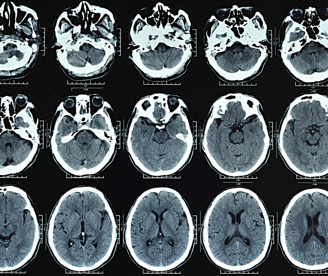 different types of scans